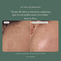Kit dúo Antimanchas™ | tranexámico 5% + despigmentante