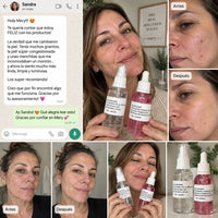Kit dúo Anti-acné™ | Triácidos + Serum reparador