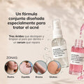 Kit dúo Anti-acné™ | Triácidos + Serum reparador