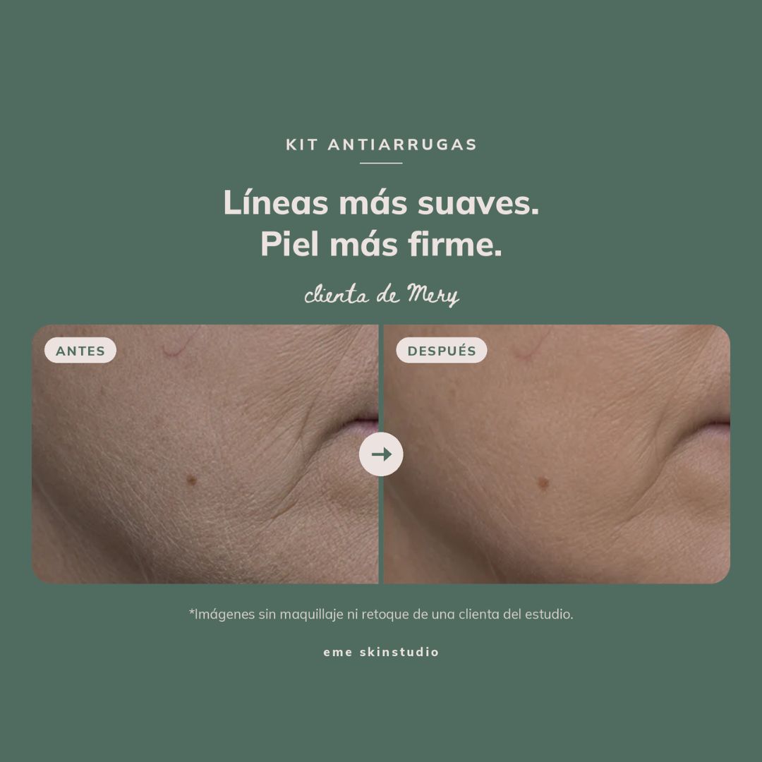 Kit Antiarrugas™ | Retinol Microencapsulado + Crema Antiage profundo