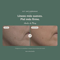 Kit Antiarrugas™ | Retinol Microencapsulado + Crema Antiage profundo